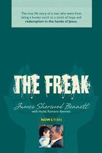 bokomslag The Freak: The true life story of a man who went from being a human torch to a torch of hope and redemption in the hands of Jesus