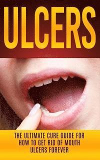 bokomslag Ulcers: The Ultimate Cure Guide for How to Get Rid of Mouth Ulcers Instantly