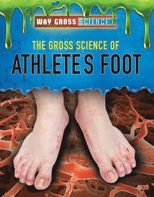 Mary-Lane Kamberg - The Gross Science of Athlete's Foot, Inbunden. Tillgänglighet: Tillfälligt slut