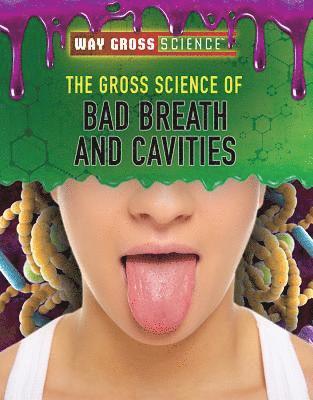 Jessica Shaw - The Gross Science of Bad Breath and Cavities, Häftad. Tillgänglighet: Lägg i varukorg