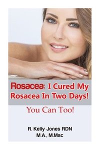 bokomslag Rosacea: I Cured My Rosacea In Two Days! You Can Too!