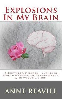 bokomslag Explosions in My Brain: A Ruptures Cerebral Aneurysm and Subarachnoid Haemorrhage; A Surviver's Story
