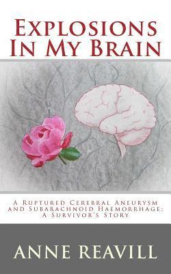 Explosions in My Brain: A Ruptures Cerebral Aneurysm and Subarachnoid Haemorrhage; A Surviver's Story 1