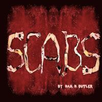 Scabs: Picking Apart The Facts 1