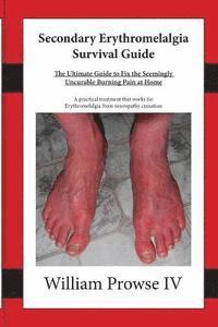 bokomslag Secondary Erythromelalgia Survival Guide