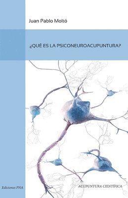 Juan Pablo Molto - Que es la Psiconeuroacupuntura, Häftad