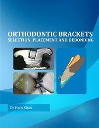 bokomslag Orthodontic Brackets: Selection, Placement and Debonding