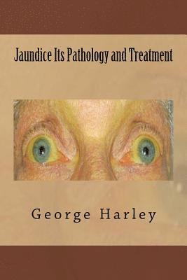 Jaundice Its Pathology and Treatment 1
