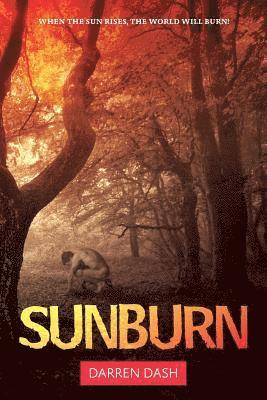 Sunburn 1