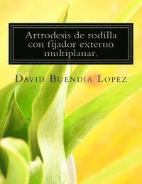 bokomslag Artrodesis de rodilla con fijador externo multiplanar.