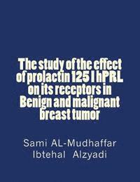 bokomslag The study of the effect of prolactin 125 I hPRL on its receptors in Benign and malignant breast tumor: Prolactin in Breast Tumors