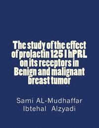 Ibtehal K. Al-Zyadee, Sami A. Al-Mudhaffar - The study of the effect of prolactin 125 I hPRL on its receptors in Benign and malignant breast tumor: Prolactin in Breast Tumors, Häftad