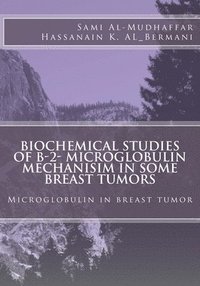 bokomslag Biochemical studies of B-2- Microglobulin Mechanisim in some Breast tumors: Microglobulin in breast tumor