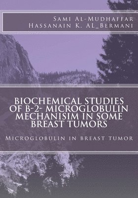 Biochemical studies of B-2- Microglobulin Mechanisim in some Breast tumors: Microglobulin in breast tumor 1