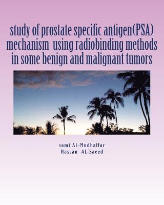 study of prostate specific antigen(PSA) mechanism using radiobinding methods in some benign and malignant tumors: PSA in tumors 1