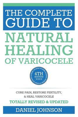 Daniel Johnson - The Complete Guide to Natural Healing of Varicocele: Varicocele natural treatment without surgery, Häftad