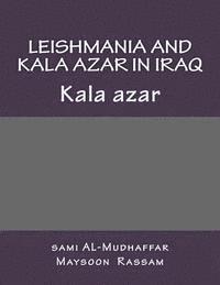 Leishmania and Kala azar in Iraq: Kala azar 1