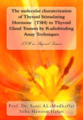 The molecular charaterization of Thyroid Stimulating Hormone (TSH) in Thyroid Gland Tumors by Radiobinding Assay Techniques: TSH in Thyroid Tumors 1