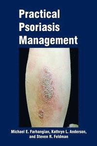 bokomslag Practical Psoriasis Management