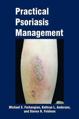 bokomslag Practical Psoriasis Management