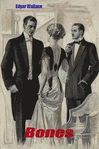 Bones