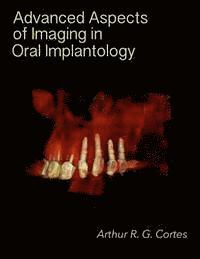 bokomslag Advanced Aspects of Imaging in Oral Implantology