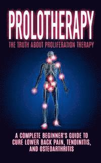 bokomslag Prolotherapy: The Truth About Proliferation Therapy: A Complete Beginner's Guide to Cure Lower Back Pain, Tendinitis, And Osteoarthr