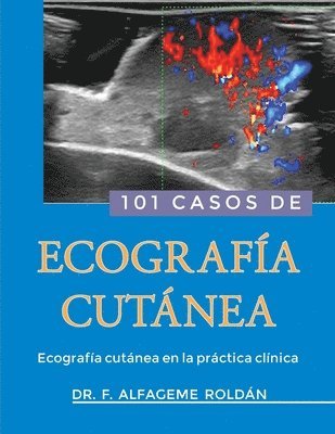 Fernando Alfageme Roldán - 101 Casos de Ecografia Cutanea: Ecografía cutánea en la práctica clínica, Häftad