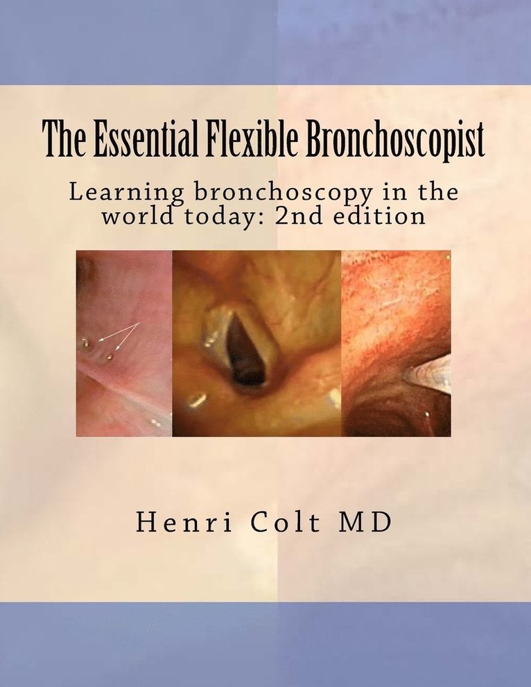 The Essential Flexible Bronchoscopist 1