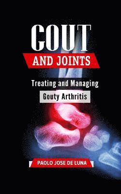 Paolo Jose De Luna - Gout and Joints: Treating and Managing Gouty Arthritis, Häftad