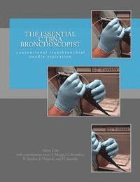 bokomslag The Essential cTBNA Bronchoscopist: conventional TransBronchial Needle Aspiration
