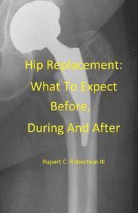 bokomslag Hip Replacement: What To Expect Before, During and After