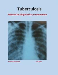 bokomslag Tratamiento de Tuberculosis: Manual de diagnóstico y tratamiento