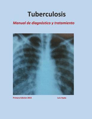 Tratamiento de Tuberculosis: Manual de diagnóstico y tratamiento 1