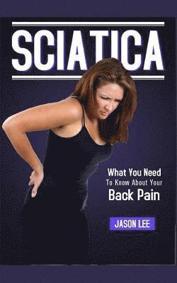 Jason Lee - Sciatica: What You Need To Know About Your Back Pain, Häftad