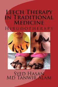 Leech Therapy in Traditional Medicine: Hirudotherapy 1