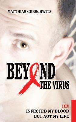 Beyond the Virus: HIV infected my blood but not my life 1