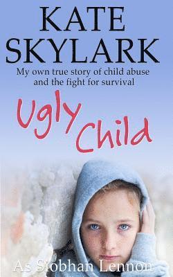 bokomslag Ugly Child: My Own True Story of Child Abuse and the Fight for Survival