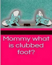 Mommy what is clubbed foot? 1