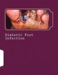 bokomslag Diabetic Foot Infection