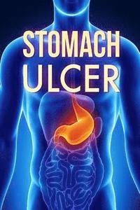 bokomslag Stomach Ulcer: Treatment in 60 days!: Stomach Ulcer treatment