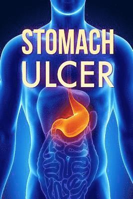 Stomach Ulcer: Treatment in 60 days!: Stomach Ulcer treatment 1