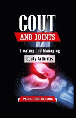 Paolo Jose De Luna - Gout And Joints: Treating and Managing Gouty Arthritis, Häftad. Tillgänglighet: Lägg i varukorg