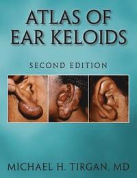 bokomslag Atlas of Ear Keloids - Second Edition