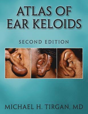 Atlas of Ear Keloids - Second Edition 1