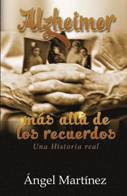 Alzheimer: Más allá de los recuerdos 1