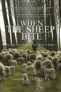 When The Sheep Bite: Loving the Church Even When it Hurts 1