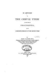 On amputation of the cervix uteri 1