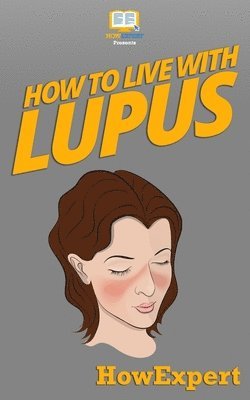 Howexpert Press - How To Live With Lupus, Häftad