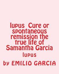 bokomslag lupus Cure or spontaneous remission the true life of Samantha Garcia: lupus